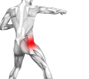 سندرم پیریفورمیس – شناخت علل وعلائم به همراه راه درمان