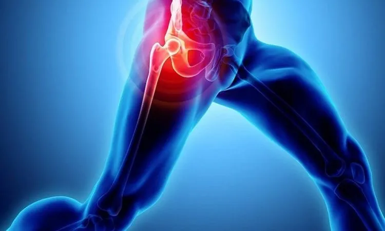 سندرم اسنپینگ هیپ .شناخت علائم ، درمان به راحتترین شکل ممکن