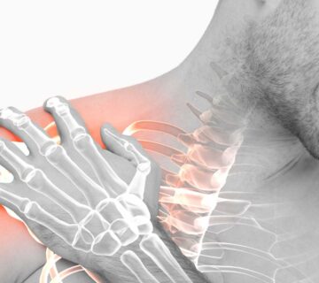 سندرم گیر افتادگی شانه – شناخت و ارائه بهترین راه درمان