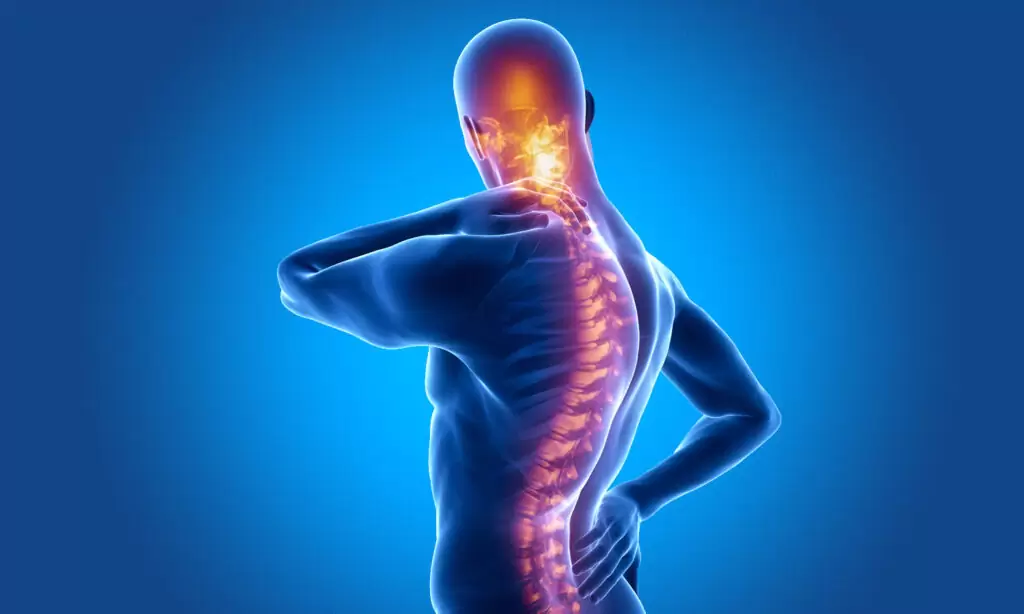 اسپوندیلیت آنکیلوزان (AS) علل و علائم به همراه بهترین راه درمان